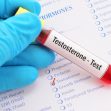 What Is Testosterone And When You Need To Test Your Levels Of Testosterone